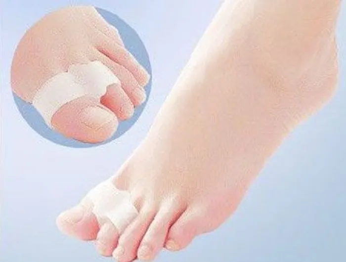 Silikon Baş Parmak Ayırıcı Koruyucu Makaralı Bunion Yüzük